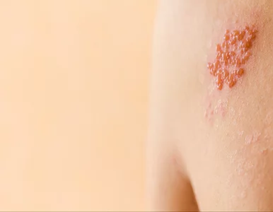 Miniatura: Prof. Paradowska-Stankiewicz: Przeciwko...