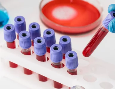 Miniatura: Wczesna diagnoza Alzheimera w zasięgu...