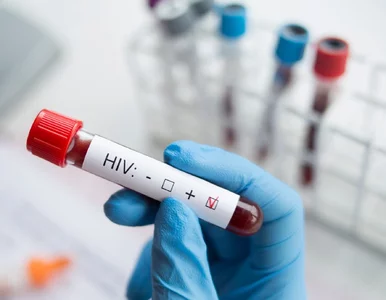 Miniatura: Codziennie przybywa chorych. Testy na HIV...