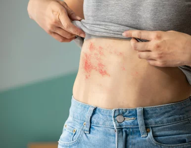 Miniatura: Na tę chorobę jest narażony każdy dorosły,...