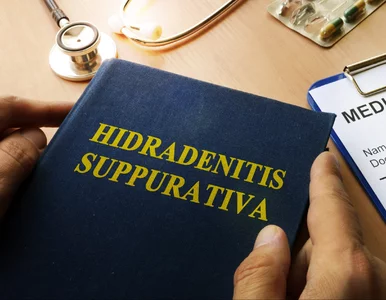 Miniatura: Ciężka choroba, trudno diagnozowana,...