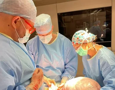 Miniatura: Usunęli guza jajnika o średnicy pół metra!...