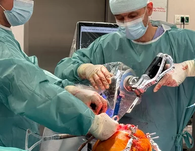 Miniatura: Robot operuje kolana w Krakowie. Mniej...