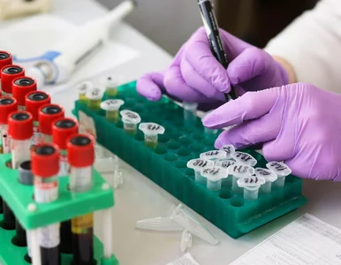 Miniatura: Badanie onkopierwiastków. Polscy onkolodzy...