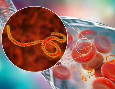 Miniatura: WHO: Obecna epidemia Eboli rozwija się...